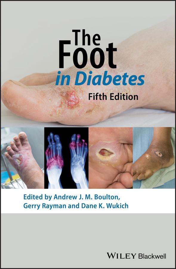 The Foot in Diabetes by Andrew J. M. Boulton, Dane K. Wukich, Gerry Rayman
