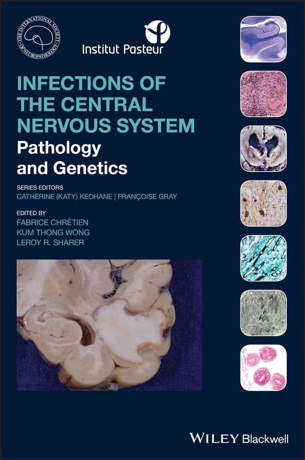 Infections of the Central Nervous System by Fabrice Chretien, Francoise Gray, Katy Keohane, Kum Thong Wong, Leroy R. Sharer