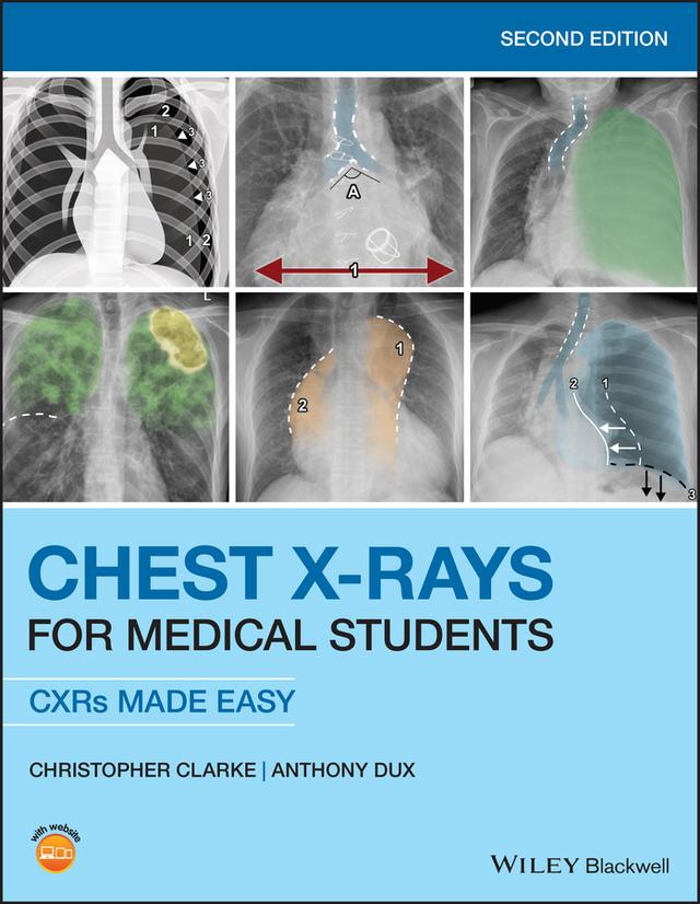 Chest X-Rays for Medical Students by Anthony Dux, Christopher Clarke