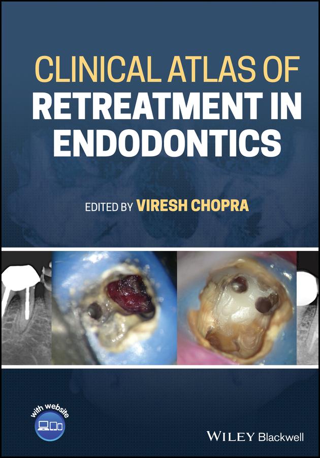 Clinical Atlas of Retreatment in Endodontics by Viresh Chopra