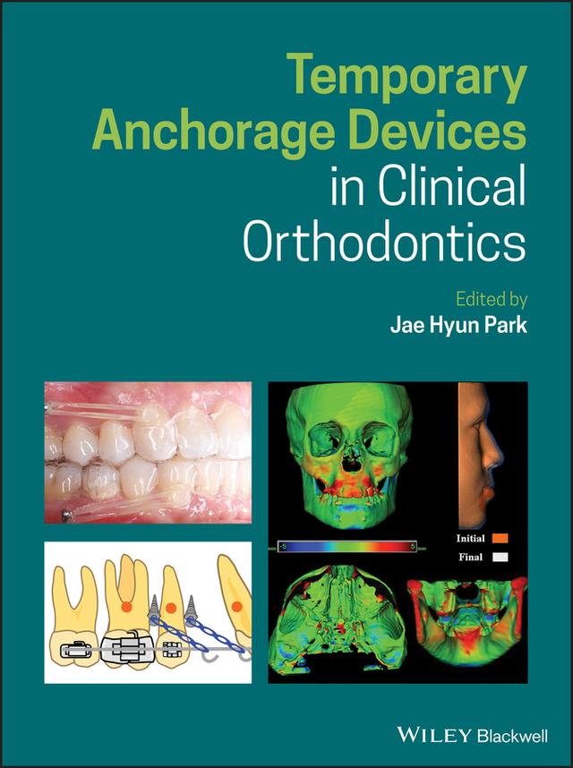 Temporary Anchorage Devices in Clinical Orthodontics by Jae Hyun Park