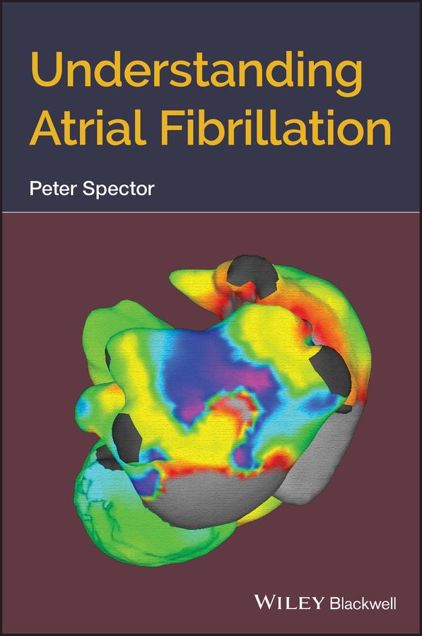 Understanding Atrial Fibrillation by Peter Spector