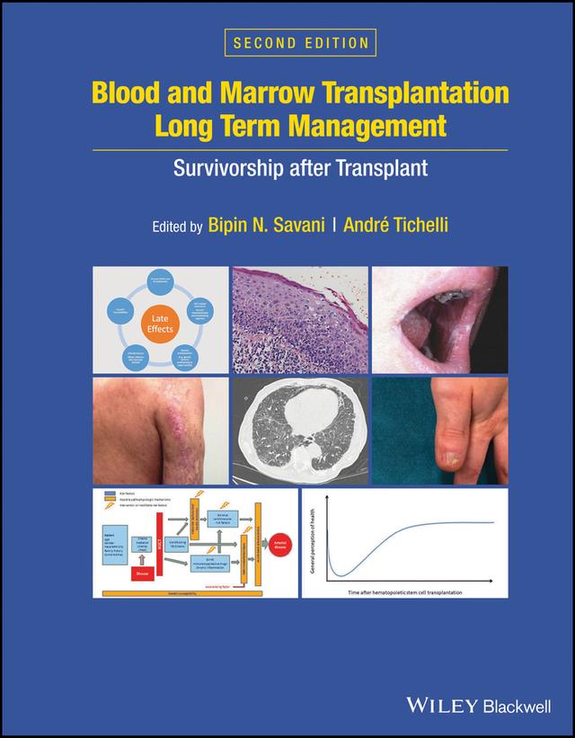 Blood and Marrow Transplantation Long Term Management by Andre Tichelli, Bipin N. Savani
