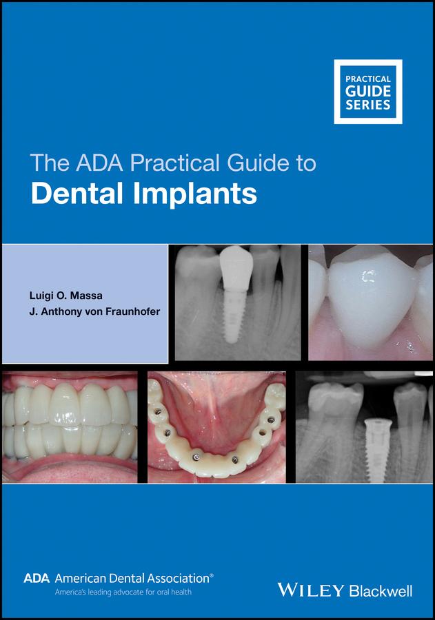 The ADA Practical Guide to Dental Implants by J. Anthony von Fraunhofer, Luigi O. Massa