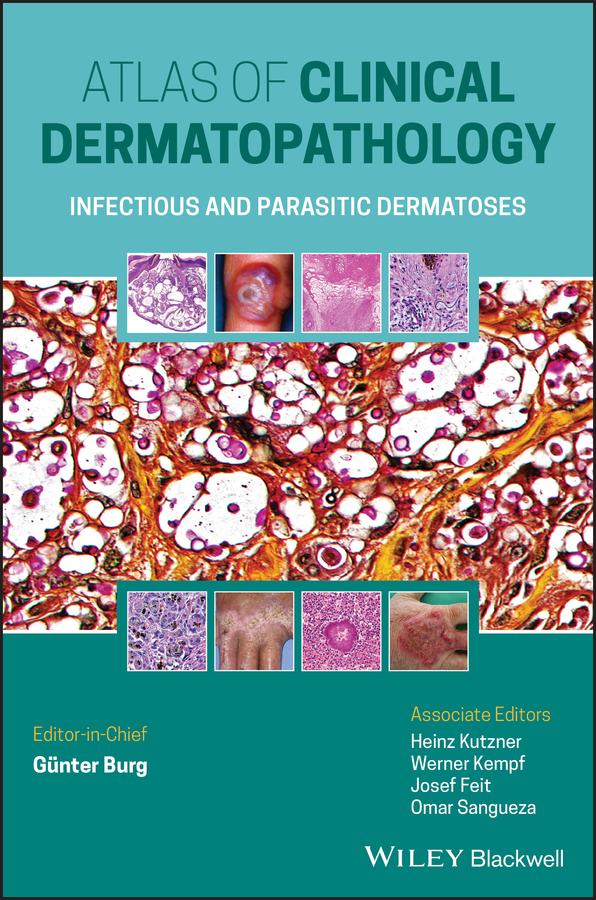Atlas of Clinical Dermatopathology by Günter Burg, Heinz Kutzner, Josef Feit, Omar Sangueza, Werner Kempf