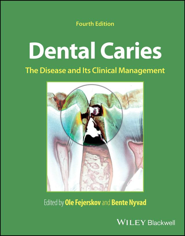 Dental Caries by Bente Nyvad, Ole Fejerskov
