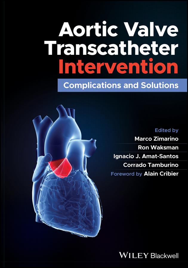 Aortic Valve Transcatheter Intervention by Corrado Tamburino, Ignacio J. Amat-Santos, Marco Zimarino, Ron Waksman