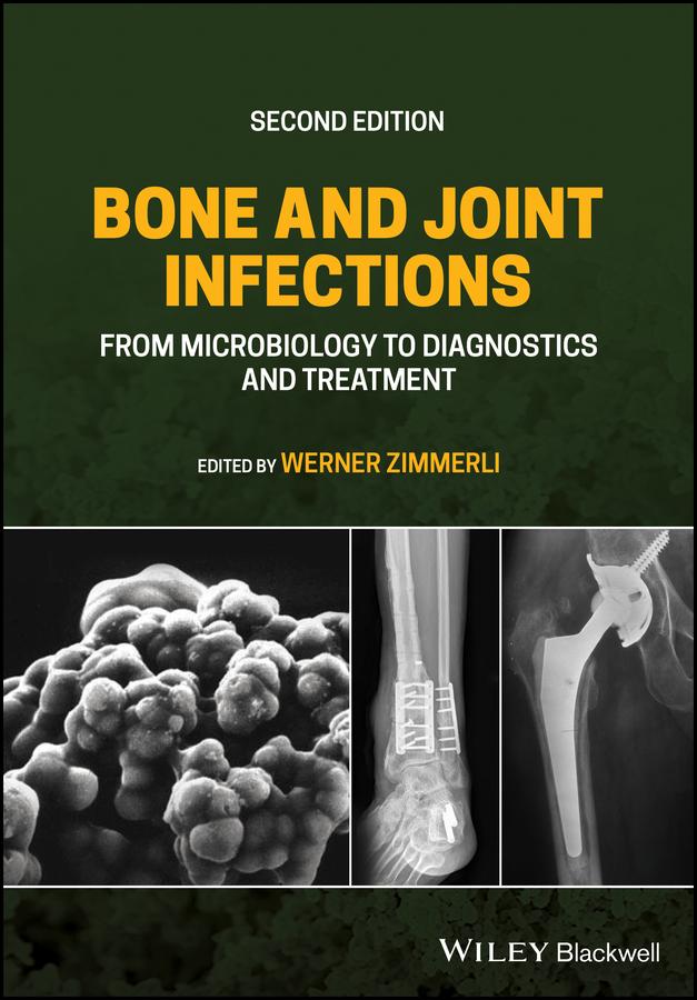 Bone and Joint Infections by Werner Zimmerli