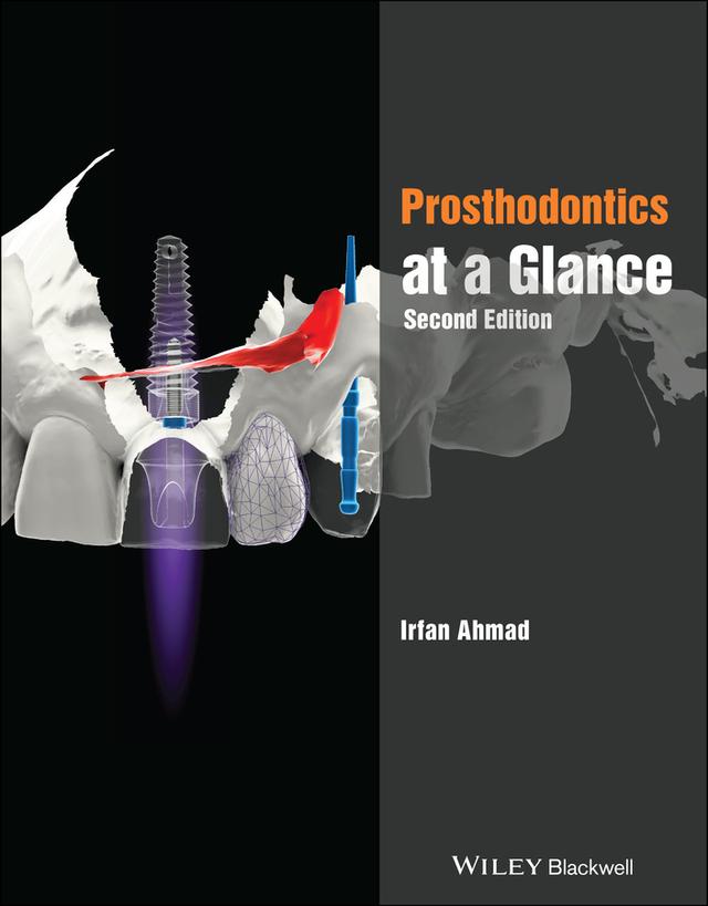 Prosthodontics at a Glance by Irfan Ahmad