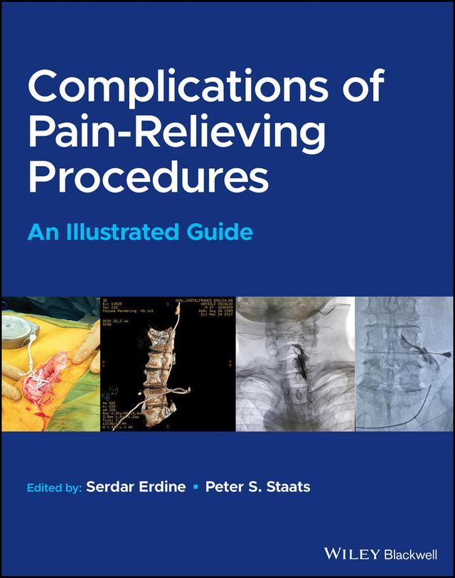 Complications of Pain-Relieving Procedures by Peter S. Staats, Serdar Erdine