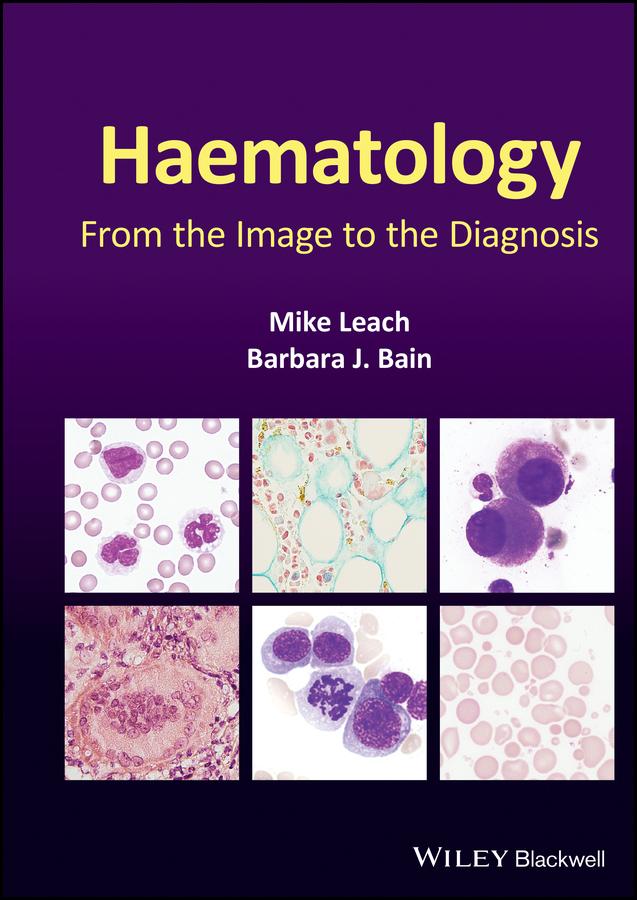 Haematology by Barbara J. Bain, Mike Leach