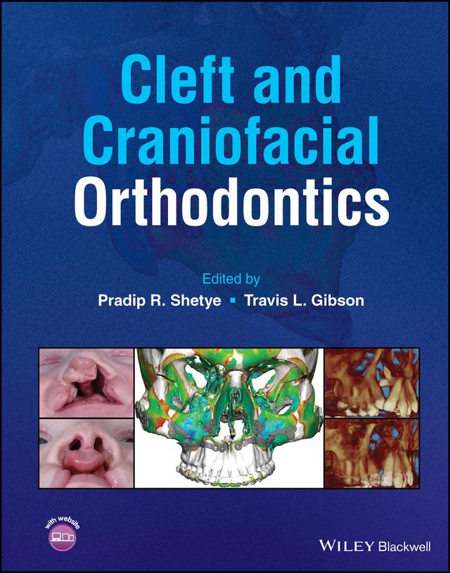 Cleft and Craniofacial Orthodontics by Pradip R. Shetye, Travis L. Gibson