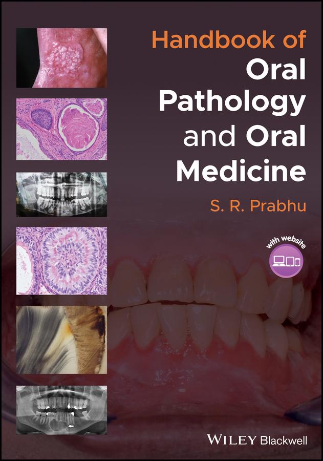 Handbook of Oral Pathology and Oral Medicine by S. R. Prabhu