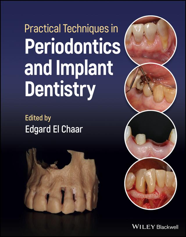 Practical Techniques in Periodontics and Implant Dentistry by Edgard El Chaar