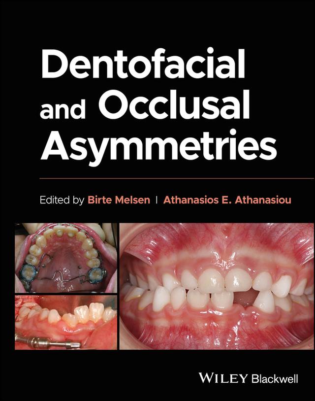 Dentofacial and Occlusal Asymmetries by Athanasios E. Athanasiou, Birte Melsen