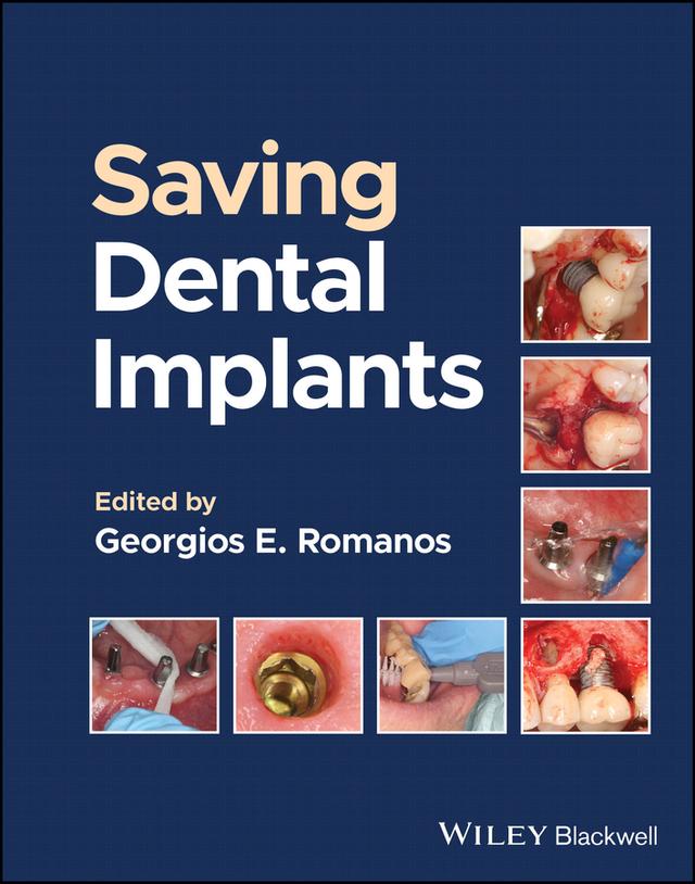 Saving Dental Implants by Georgios E. Romanos