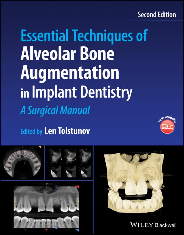 Essential Techniques of Alveolar Bone Augmentation in Implant Dentistry by Len Tolstunov