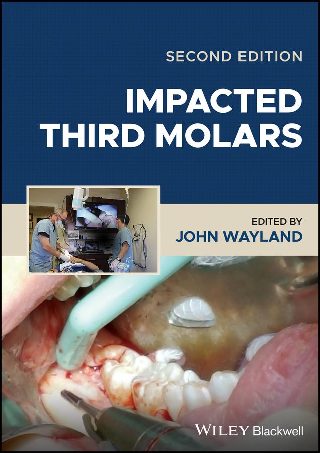 Impacted Third Molars by John Wayland