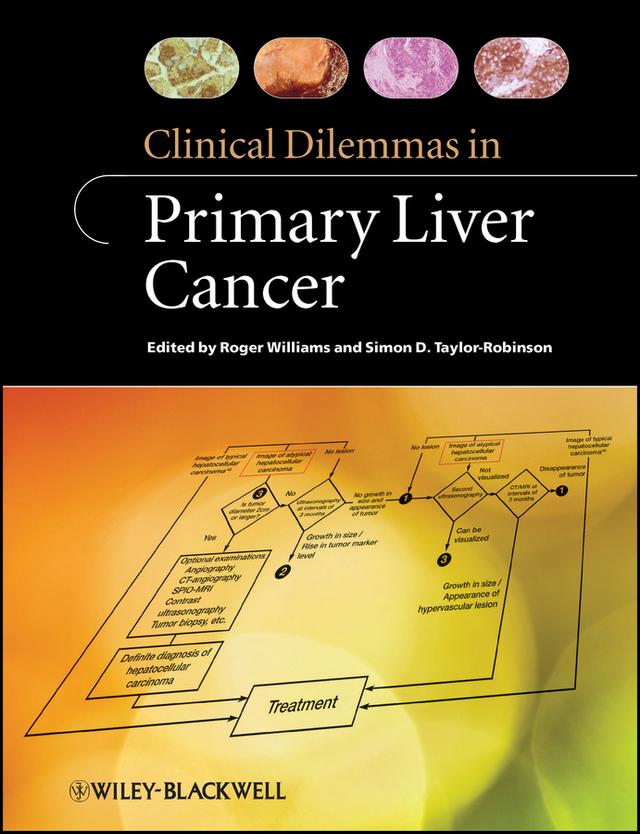 Clinical Dilemmas in Primary Liver Cancer by Roger Williams, Simon D. Taylor-Robinson
