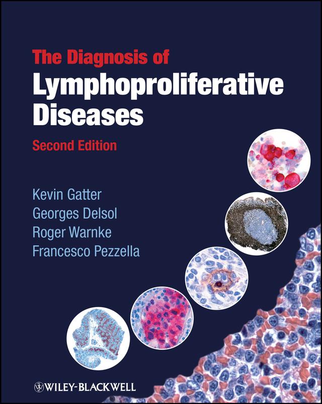 The Diagnosis of Lymphoproliferative Diseases by Francesco Pezzella, Georges Delsol, Kevin Gatter, Roger Warnke