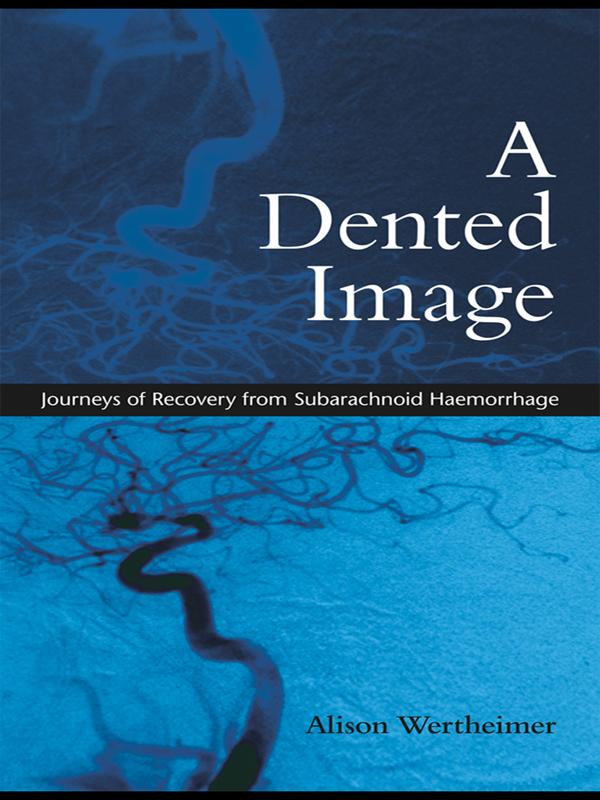A Dented Image by Alison Wertheimer