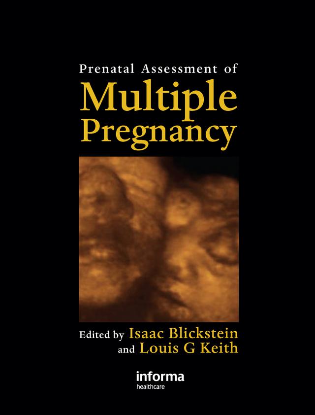 Prenatal Assessment of Multiple Pregnancy by Isaac Blickstein, Louis G. Keith