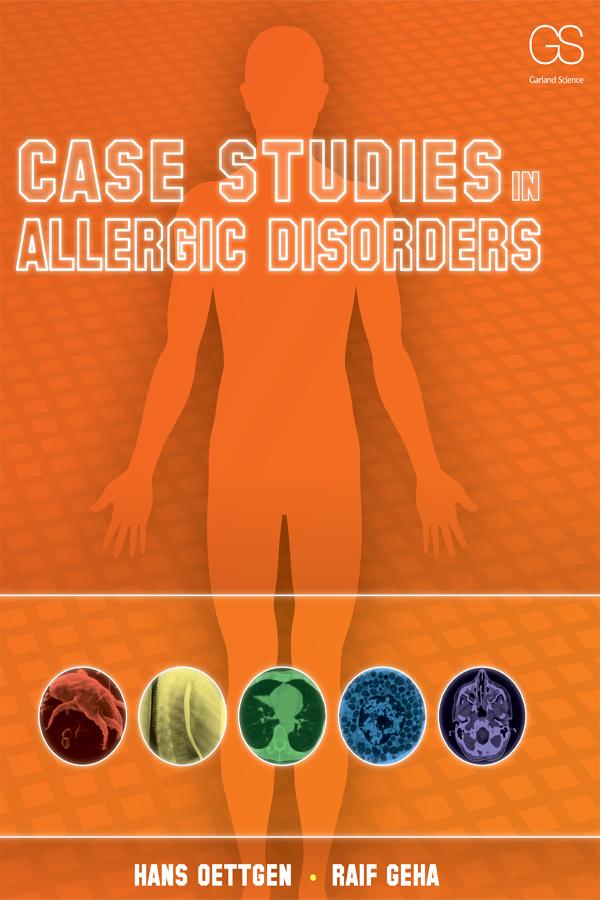 Case Studies in Allergic Disorders by Hans Oettgen, Raif Geha