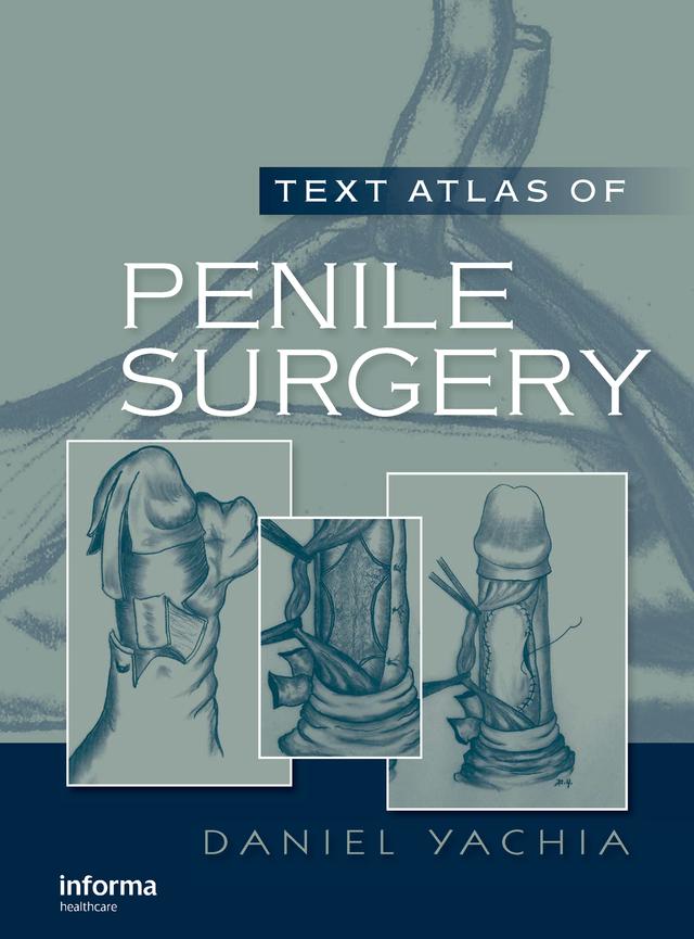 Text Atlas of Penile Surgery by Daniel Yachia