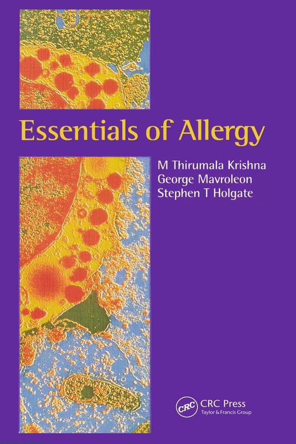 Essentials of Allergy by George Mavroleon, M Thirumala Krishna, Stephen T Holgate