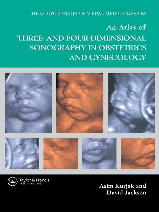 An Atlas of Three- and Four-Dimensional Sonography in Obstetrics and Gynecology by Asim Kurjak, David Jackson