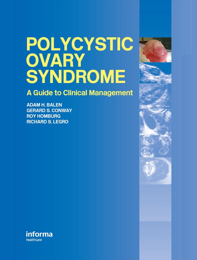 Polycystic Ovary Syndrome by Adam H. Balen, Gerard Conway, Richard Legro, Roy Homburg