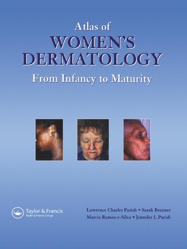 Atlas of Women's Dermatology by Jennifer L. Parish, Lawrence Charles Parish MD, Marcia Ramos e Silva, Sara Brenner