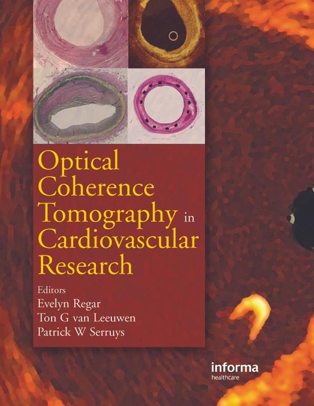 Optical Coherence Tomography in Cardiovascular Research by A.M.G.J. van Leeuwen, Evelyn Regar, Patrick W. Serruys
