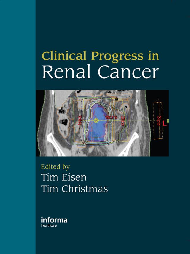 Clinical Progress in Renal Cancer by Tim Christmas, Tim Eisen