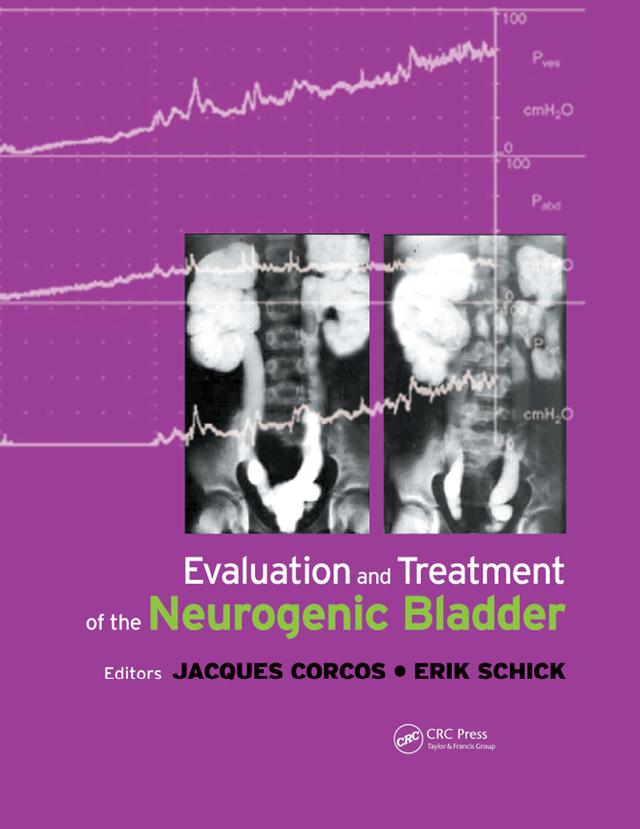 Evaluation and Treatment of the Neurogenic Bladder by Eric Schick, Jacques Corcos