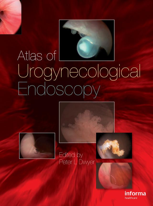 Atlas of Urogynecological Endoscopy by Peter L. Dwyer