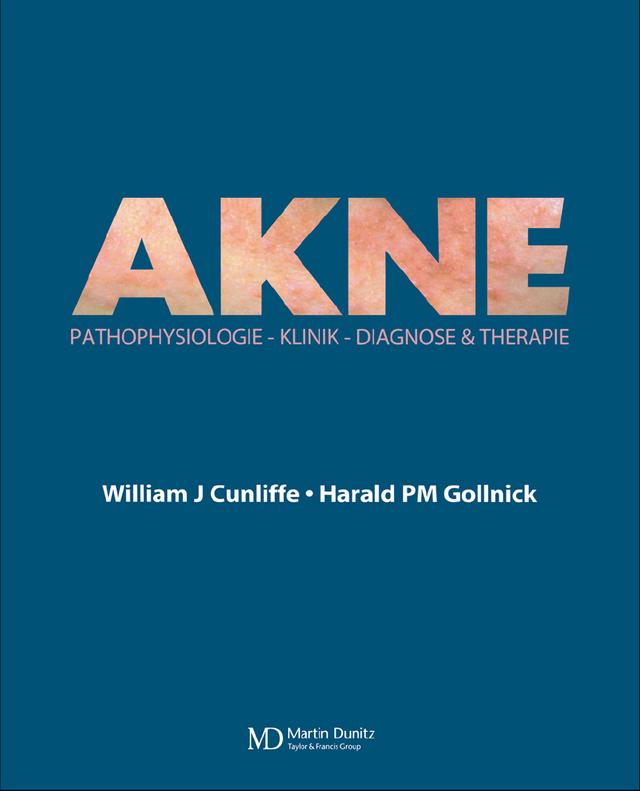 Acne by Harald PM Gollnick, William J Cunliffe
