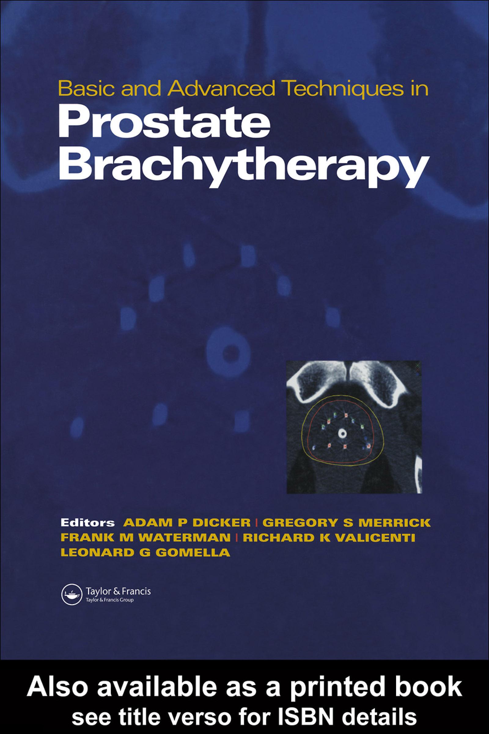 Basic and Advanced Techniques in Prostate Brachytherapy
