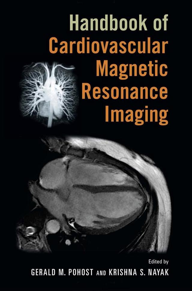 Handbook of Cardiovascular Magnetic Resonance Imaging by Gerald M. Pohost, Krishna S. Nayak