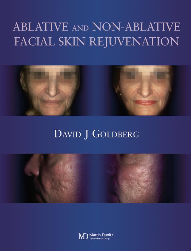 Ablative and Non-ablative Facial Skin Rejuvenation by David J. Goldberg