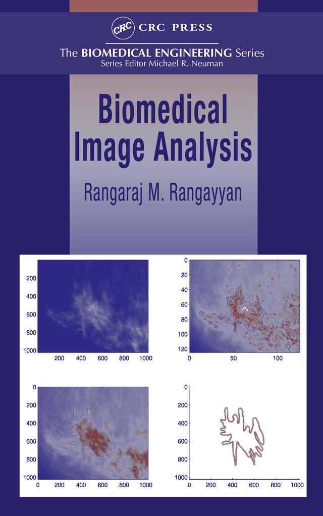 Biomedical Image Analysis by Rangaraj M. Rangayyan
