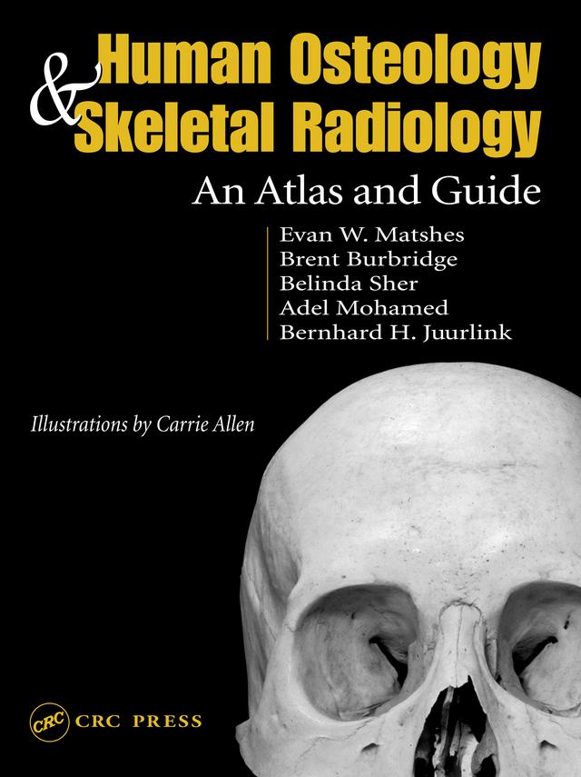 Human Osteology and Skeletal Radiology by Bernard Juurlink, Evan W. Matshes