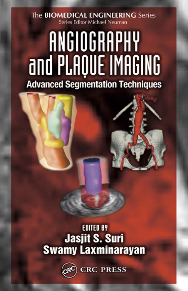 Angiography and Plaque Imaging by Jasjit S. Suri, Swamy Laxminarayan