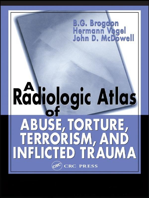A Radiologic Atlas of Abuse, Torture, Terrorism, and Inflicted Trauma by B. G. Brogdon, Hermann Vogel, John D. McDowell