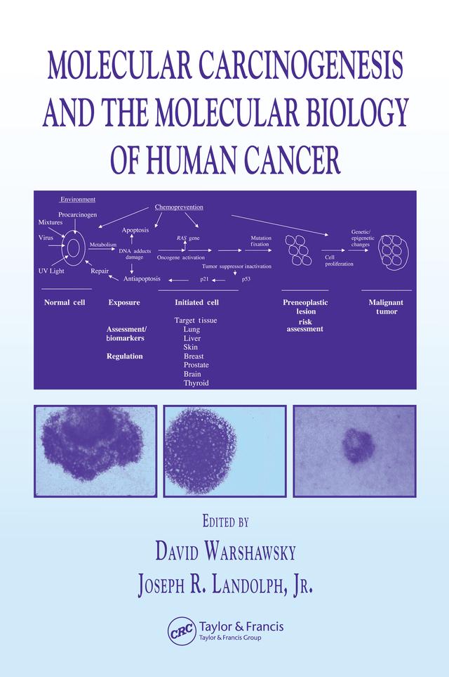 Molecular Carcinogenesis and the Molecular Biology of Human Cancer by David Warshawsky, Joseph R. Landolph Jr.