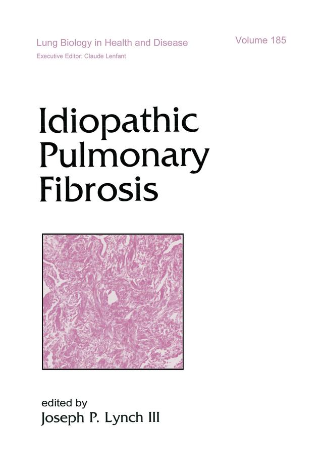 Idiopathic Pulmonary Fibrosis by Joseph P. Lynch