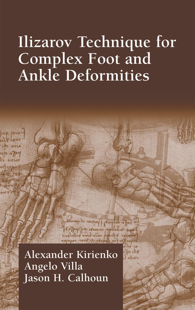Ilizarov Technique for Complex Foot and Ankle Deformities by Alexander Kirienko, Angelo Villa, Jason H. Calhoun