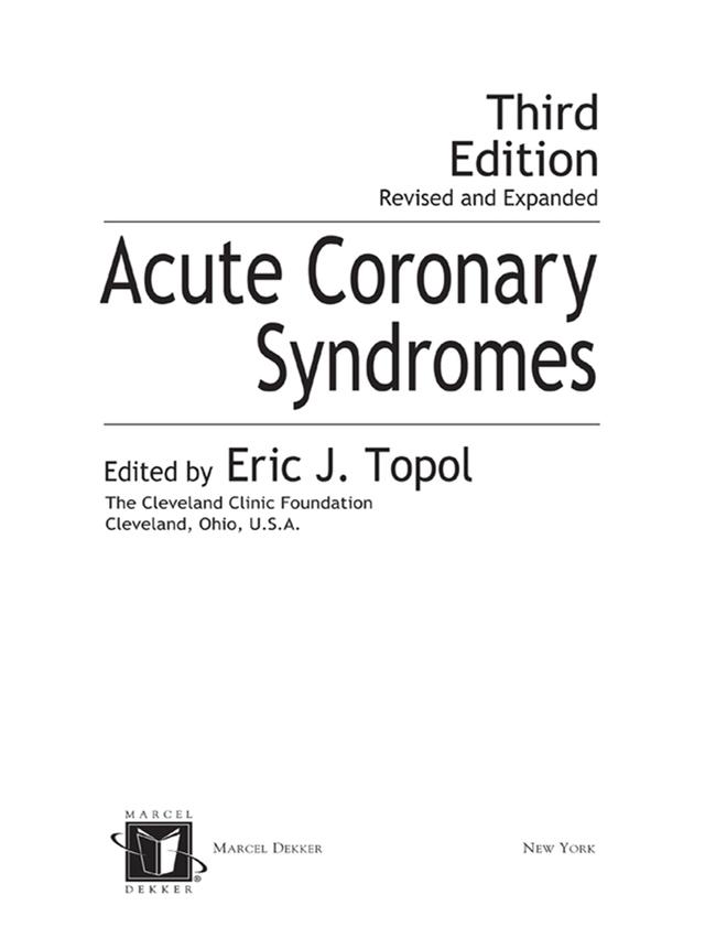 Acute Coronary Syndromes by Eric Topol