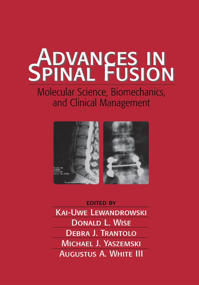 Advances in Spinal Fusion by Kai-Uwe Lewandrowski