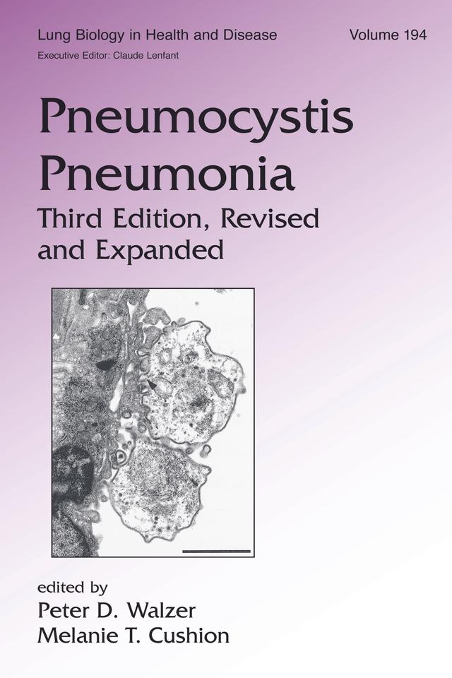 Pneumocystis Pneumonia by Melanie T. Cushion, Peter Walzer